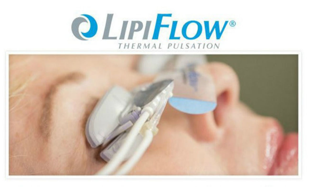 lipiflow treatments